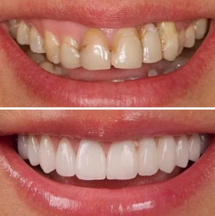 What is cosmetic dentistry